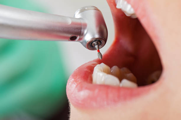 Best Emergency Dental Services for Seniors in Medina, WA